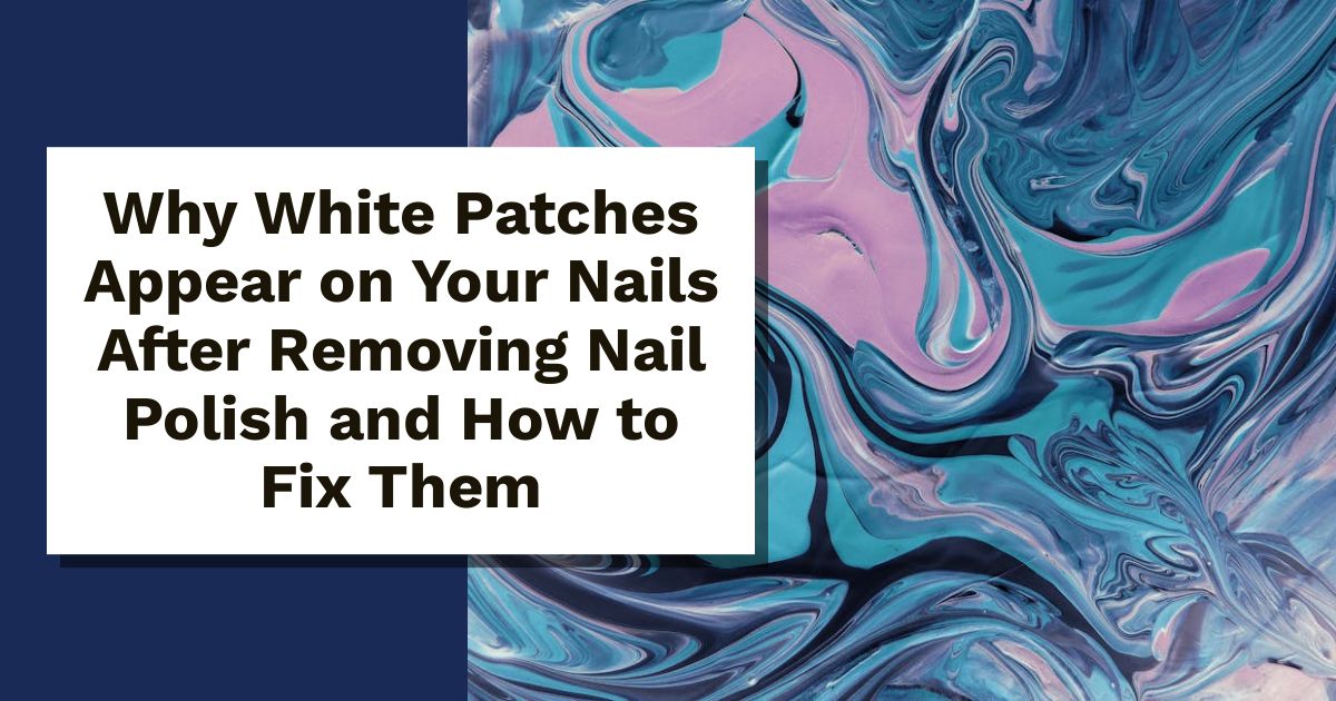 Why White Patches Appear on Your Nails After Removing Nail Polish and How to Fix Them